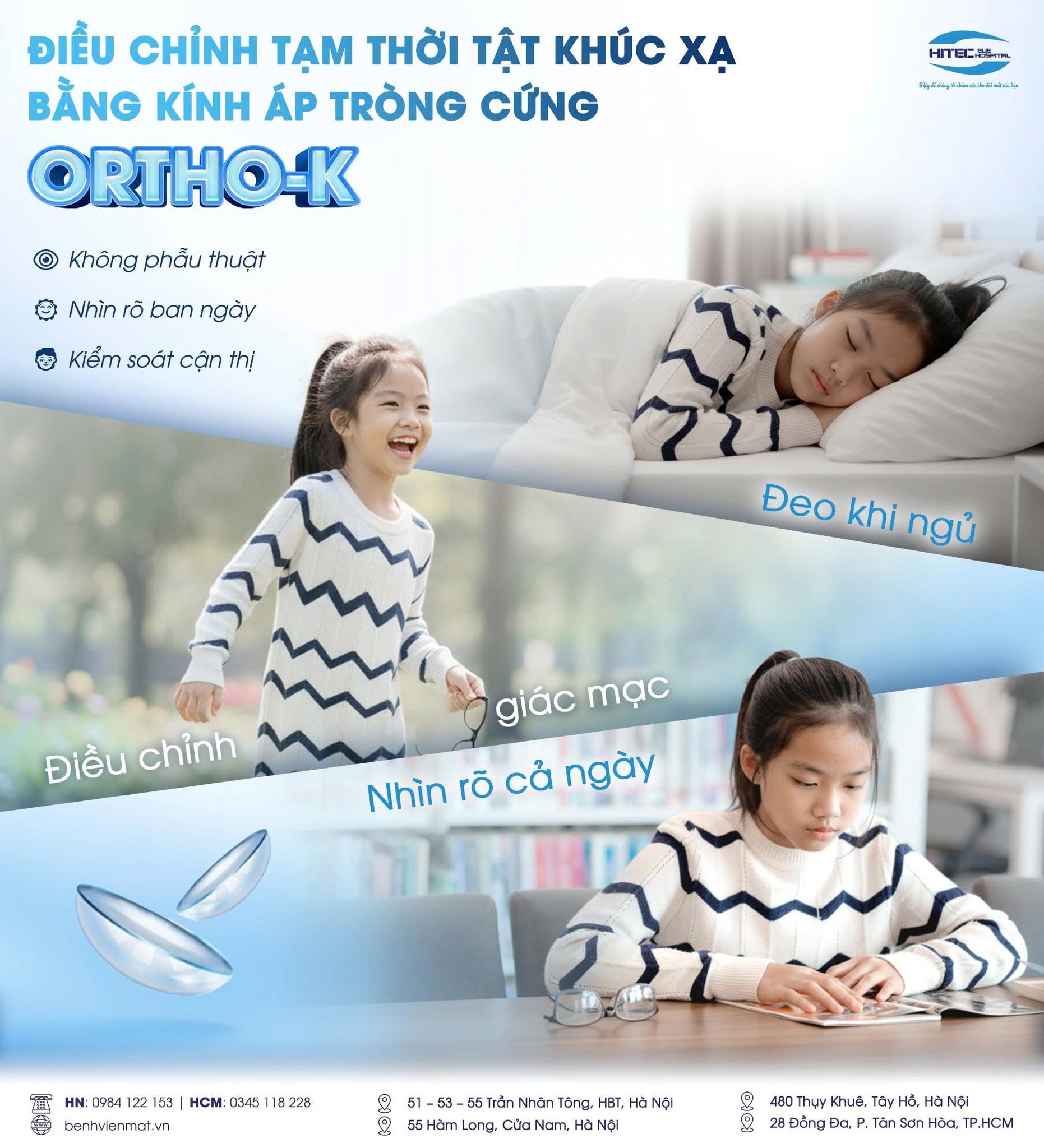 ortho-k-la-gi-nhung-dieu-bo-me-can-biet-truoc-khi-lua-chon-phuong-phap-kiem-soat-can-thi-cho-tre