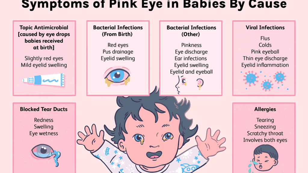                  Nguyên nhân và triệu chứng đau mắt đỏ (viêm kết mạc) ở trẻ thường gặp